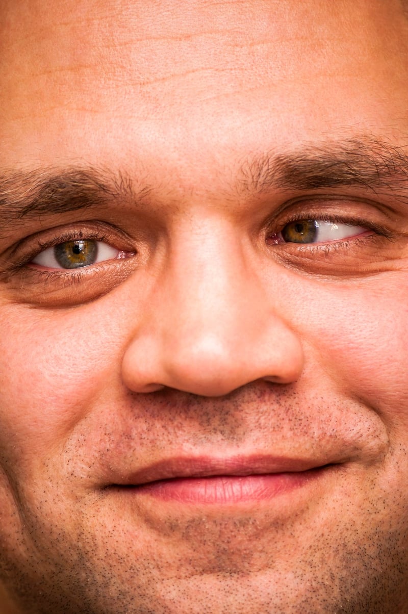 Strabismus Crossed Eyes